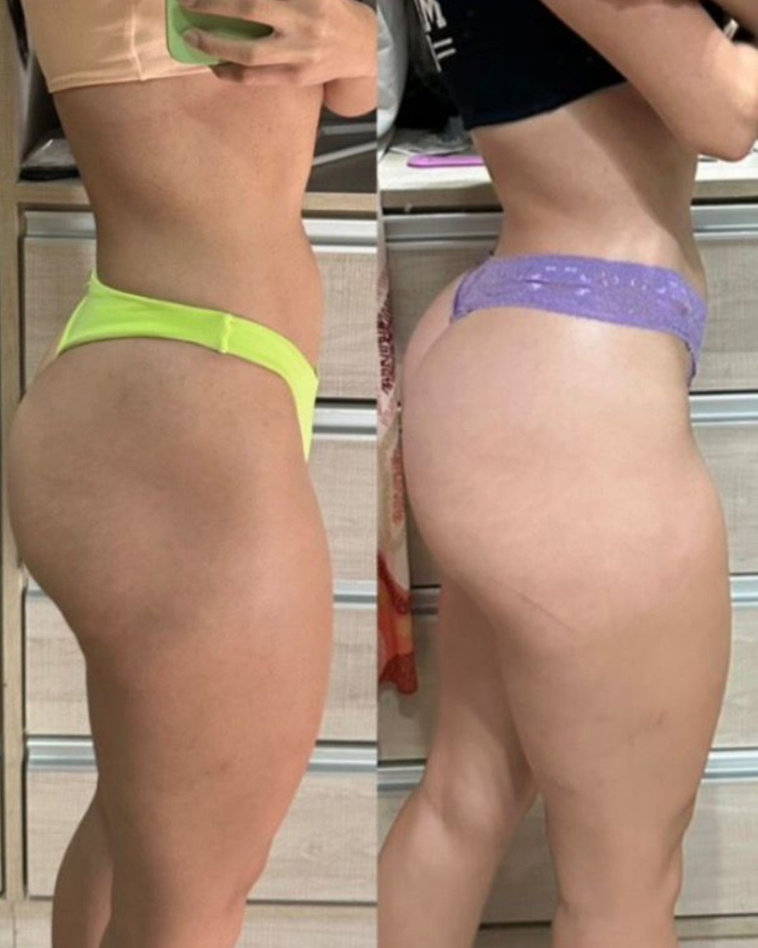 Transformação de 4 meses, glúteos